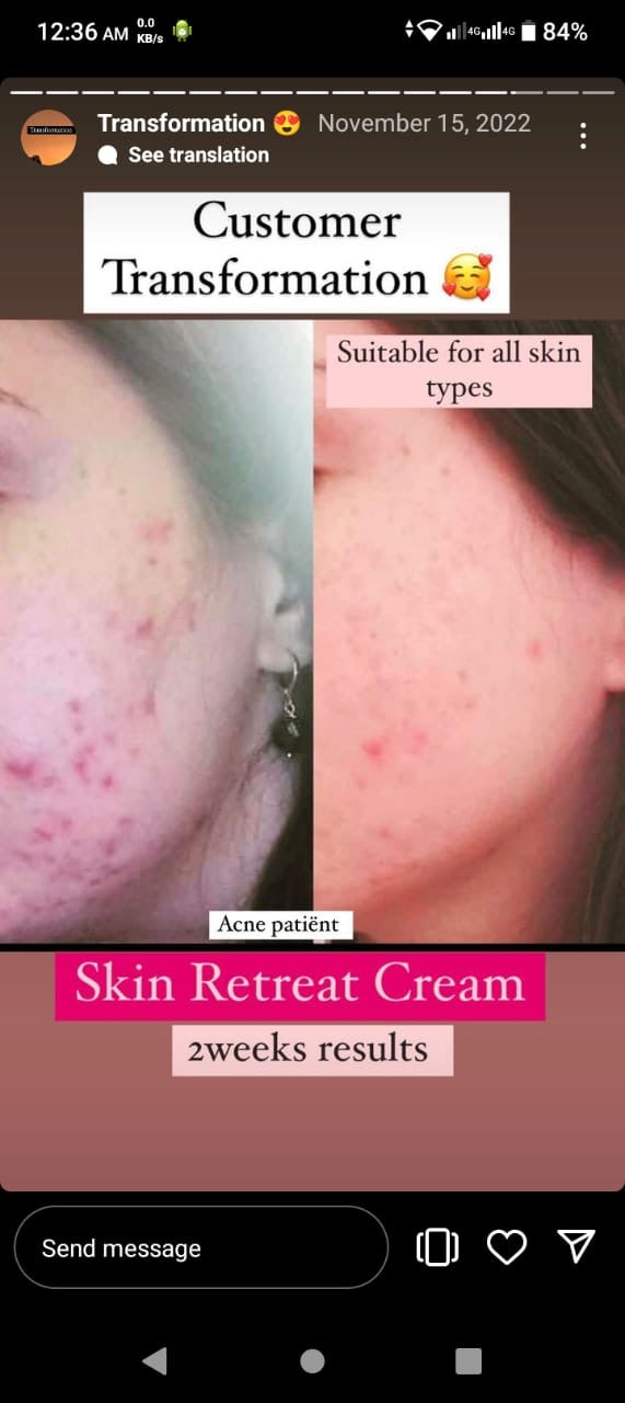 Skin Retreat Cream