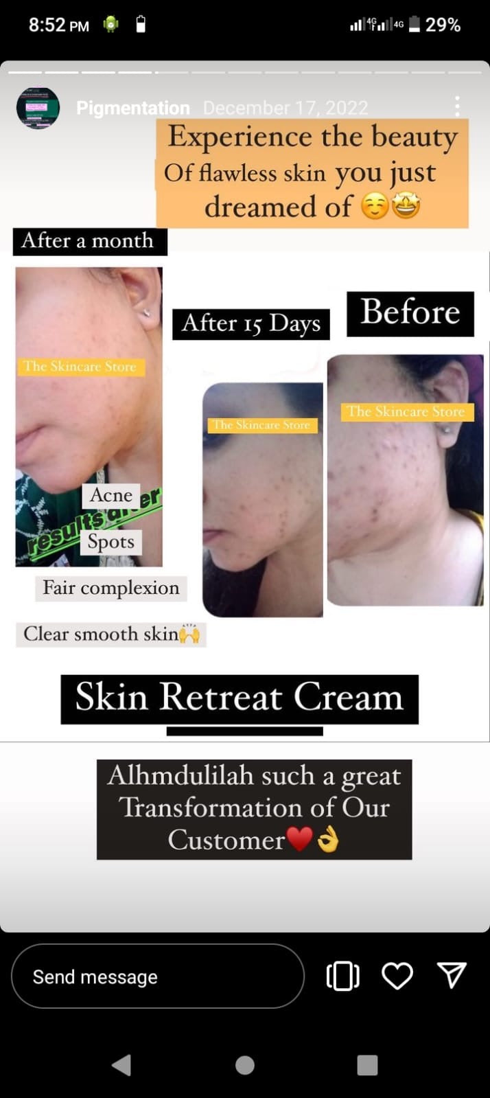 Skin Retreat Cream